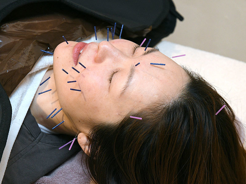 美容鍼/耳鍼/美顔筋トレ