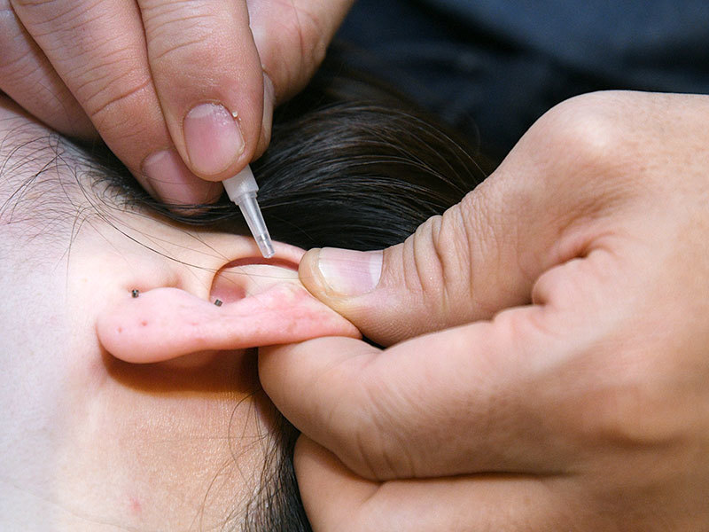 美容鍼/耳鍼/美顔筋トレ