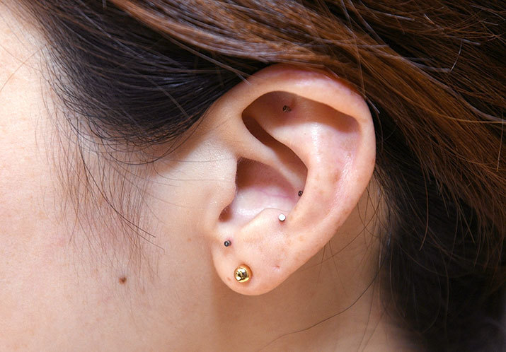 耳ばり　ASP鍼　チタン鍼　BFA戦場鍼