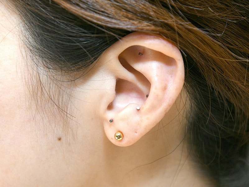 美容鍼/耳鍼/美顔筋トレ